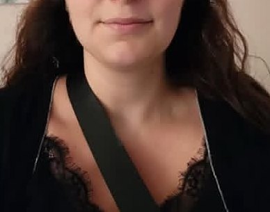 Client jawline before double chin treatment
