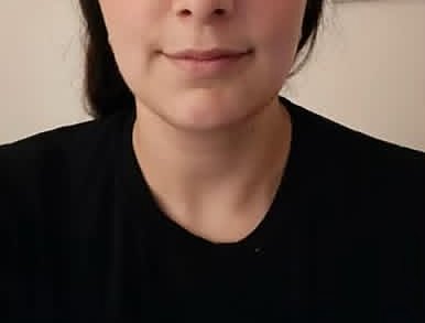 Client jawline after five sessions